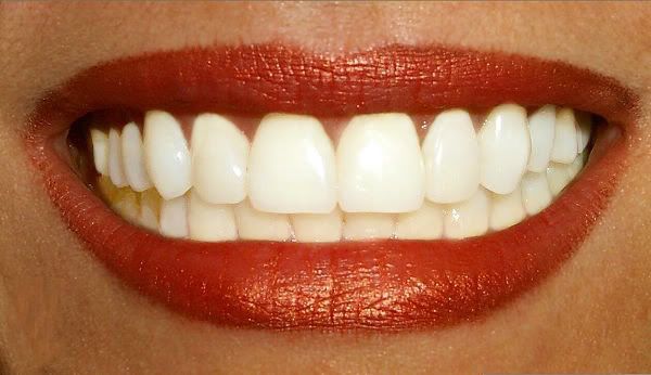 WHITE TEETH Pictures, Images and Photos
